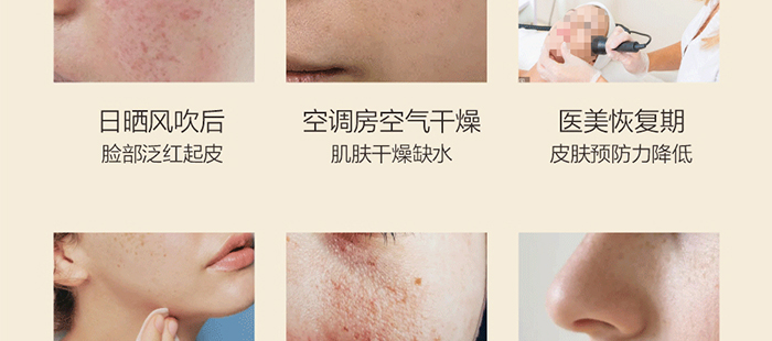 貝爾薇詩活性麥盧卡補水修復(fù)精華