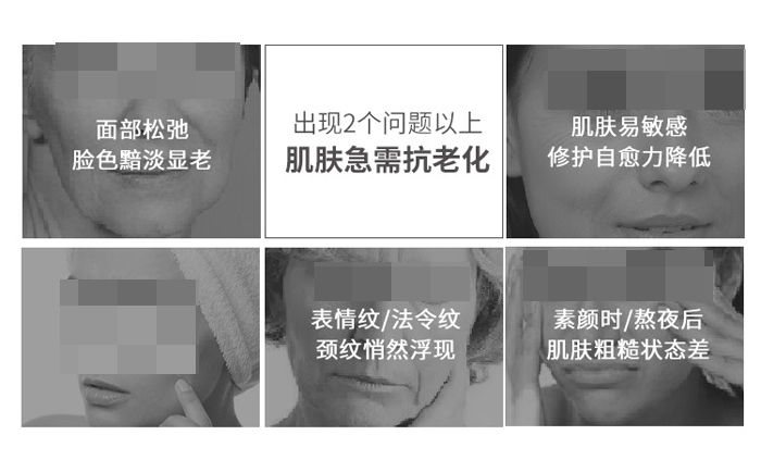 愛貝琳卡多肽抗衰套